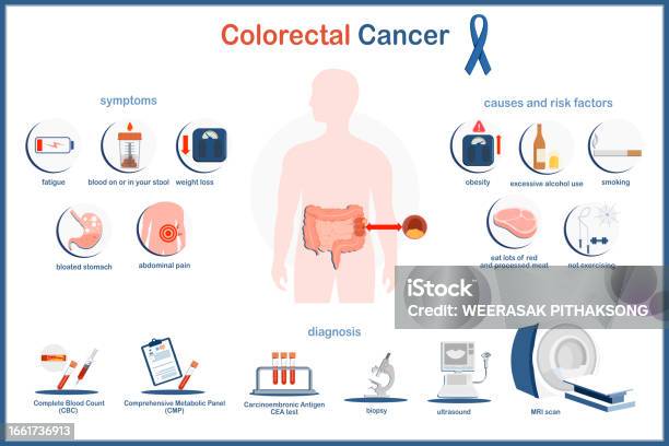 colon cancer vertaling