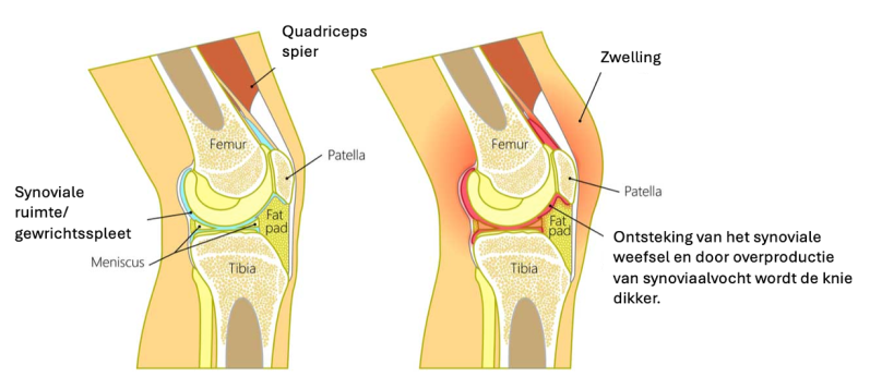 cartilage vertaling